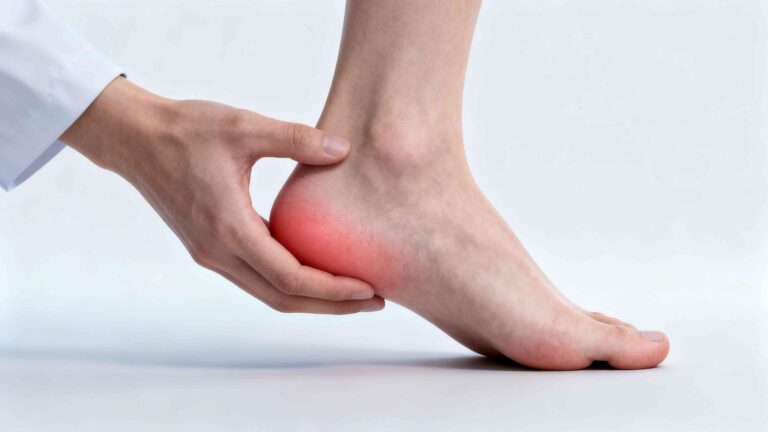 “Realistic clinical image of a human heel showing subtle differences associated with plantar fasciitis and heel spurs for comparison